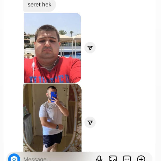 KETO BLACK KIT ( Free Delivery )