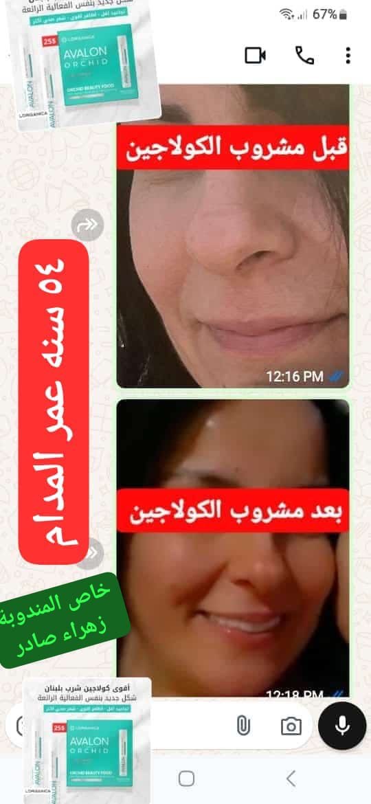 Collagen Ampules 7500mg ( Advanced Collagen)