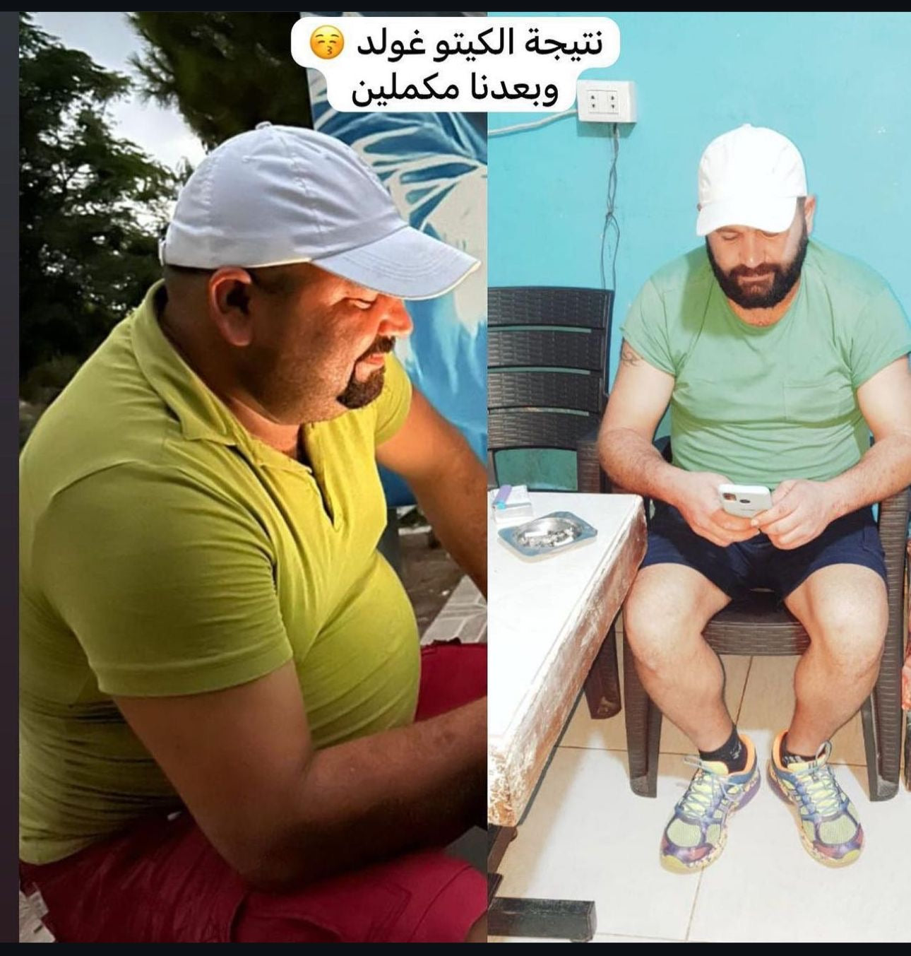 KETO GOLD KIT ( Free Delivery )