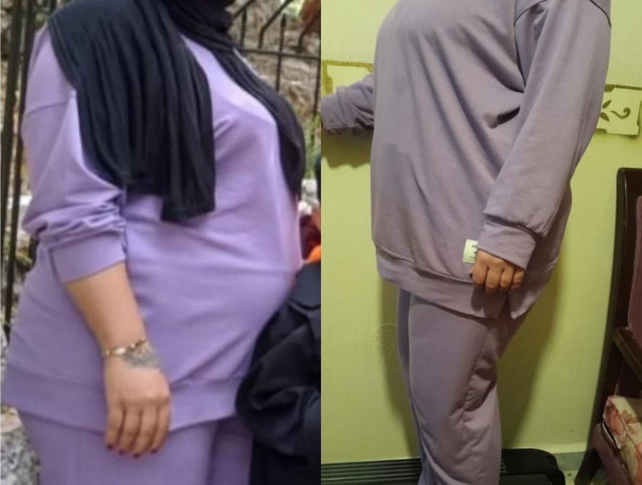 KETO BLACK KIT ( Free Delivery )