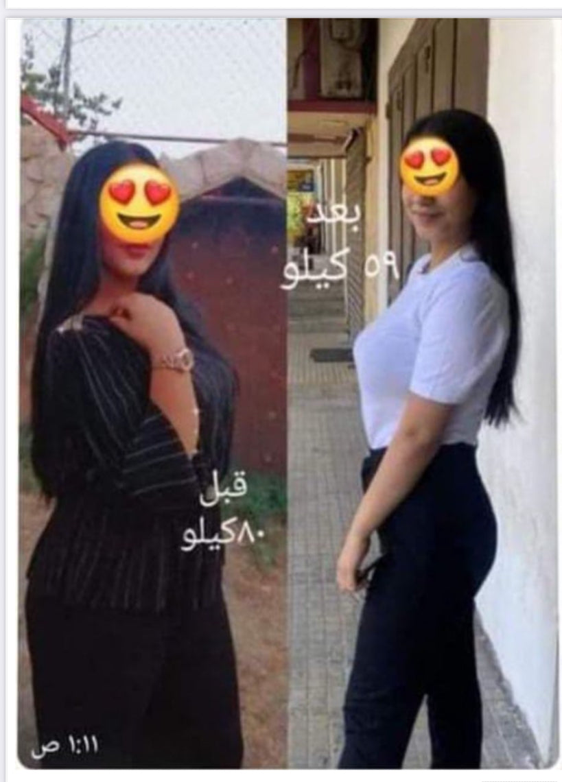 Gold Kit  + Slimming Cream (Free Delivery)