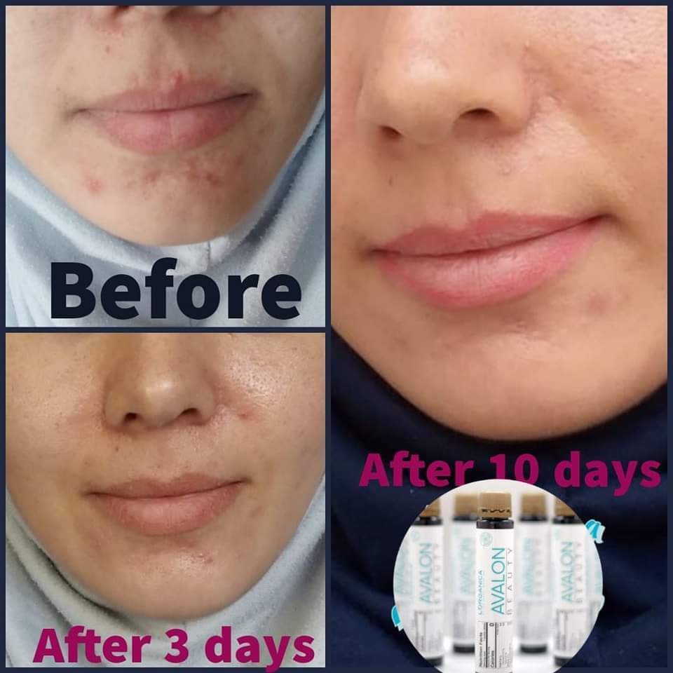 Collagen 6000mg