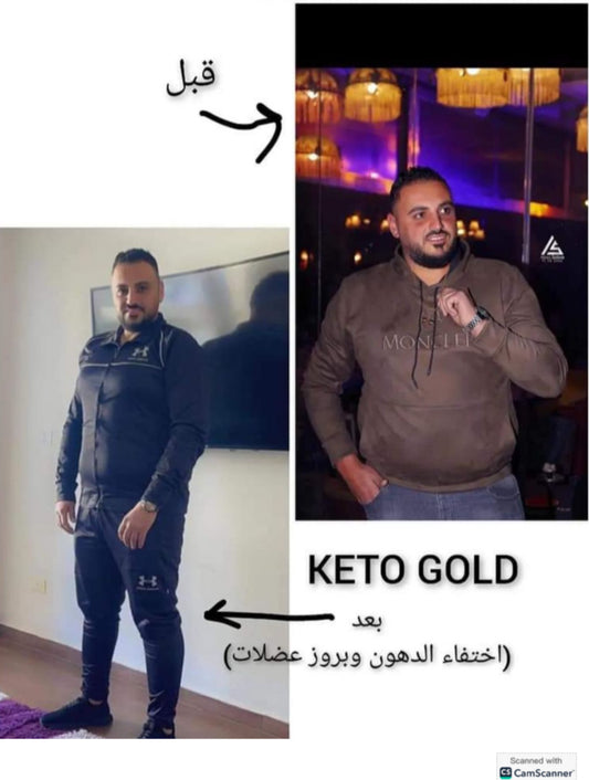 Gold Kit  + Slimming Cream (Free Delivery)