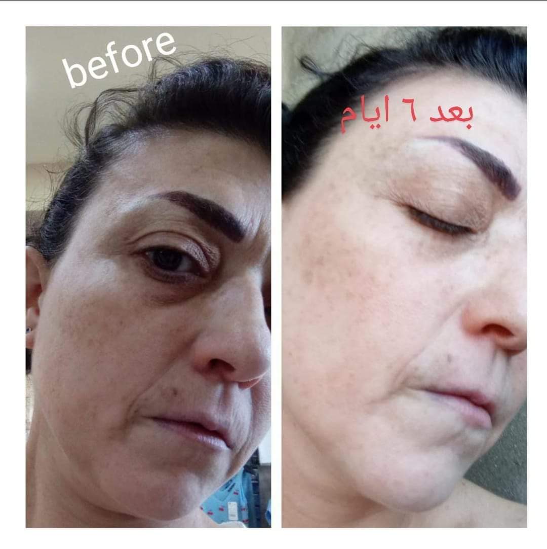 Collagen 6000mg