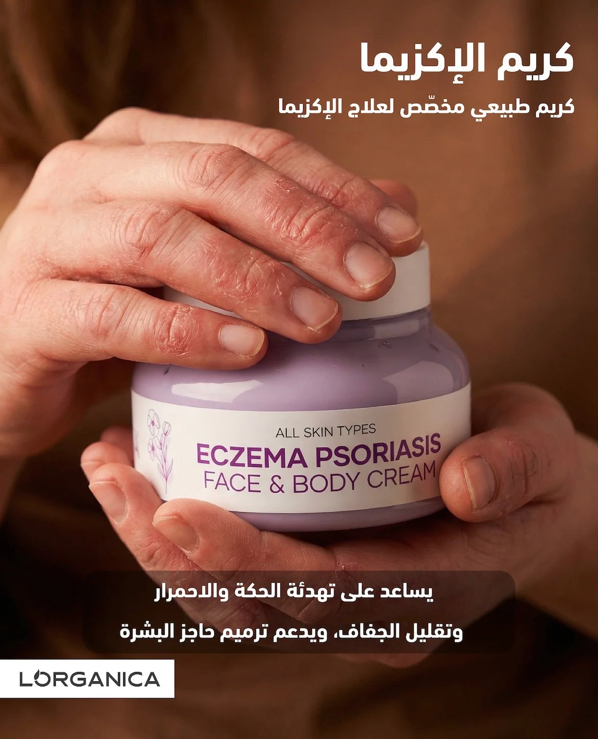 ECZEMA CREAM كريم الأكزيما
